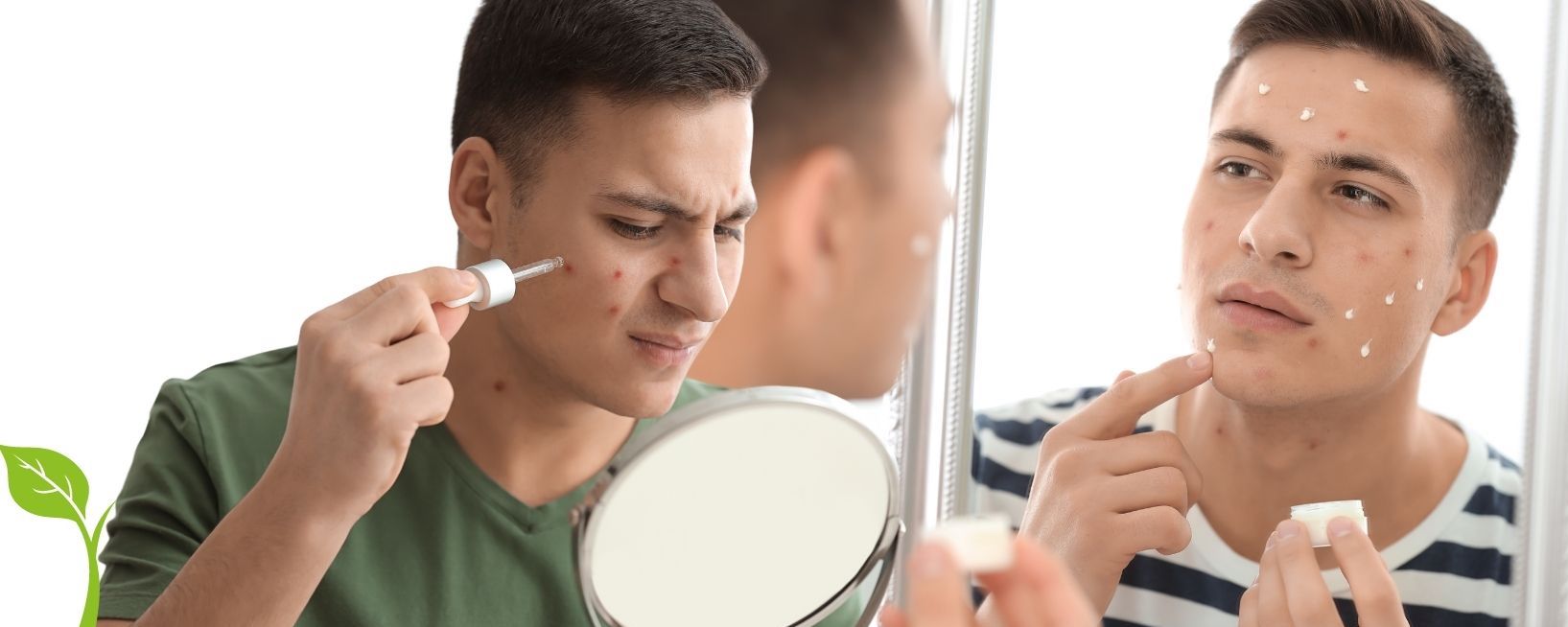 Pickel erfolgreich entfernen - So wirst Du deine Pickel für immer los
